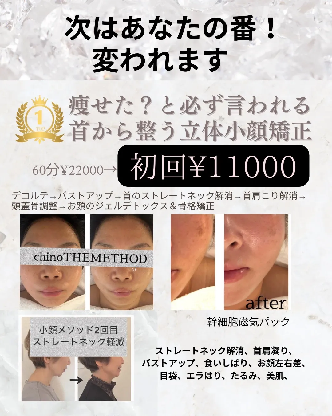 チノザメソッド(美骨師MIKI)ボディ&小顔矯正コース